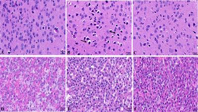 Copper deposition in Wilson’s disease causes male fertility decline by impairing reproductive hormone release through inducing apoptosis and inhibiting ERK signal in hypothalamic-pituitary of mice